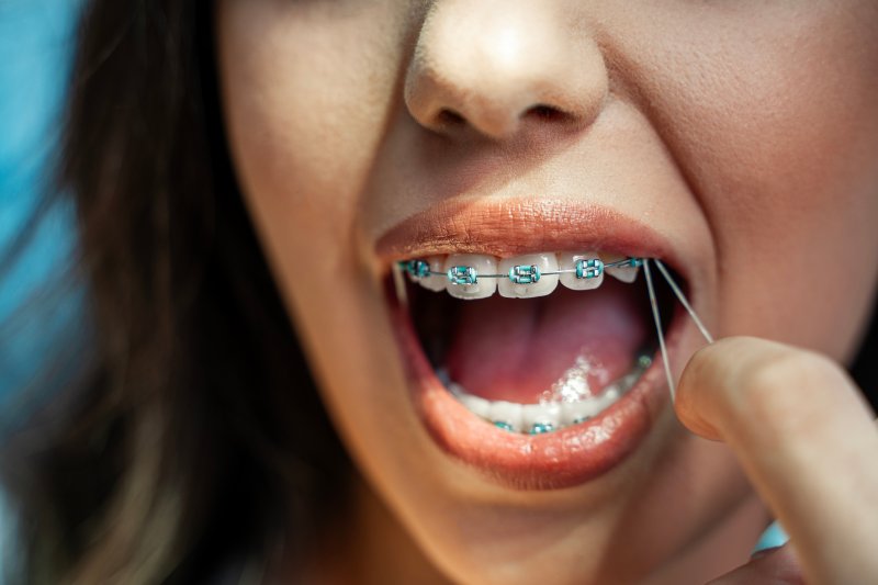 Teen with braces